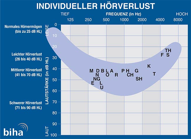 Sprachbanane verdeutlicht individuellen Hörverlust