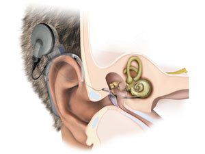 Können Hörgerät und Cochlea-Implantat vor geistigem Abbau im Älter schützen? Können Hörgerät und Cochlea-Implantat vor geistigem Abbau im Älter schützen?