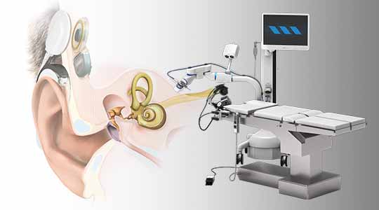 Erstes Cochlea Implantat mithilfe eines Roboters eingesetzt