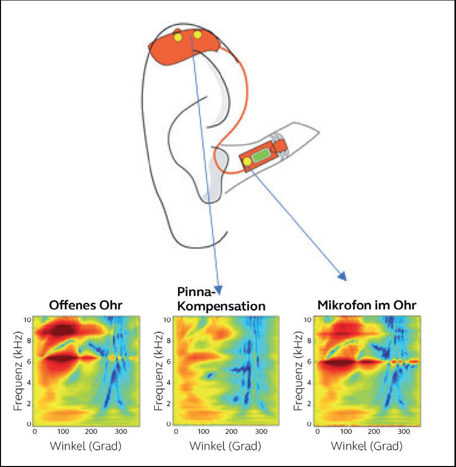 ReSound M&RIE Vergleich