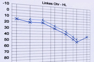 Hörtest Leverkusen