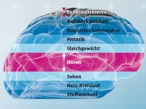 Oticon BrainHearing Schwerhörigkeit